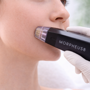MORPHEUS 8 POMULOS