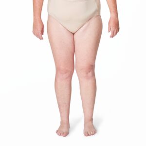 ENDOLIFTING RODILLAS