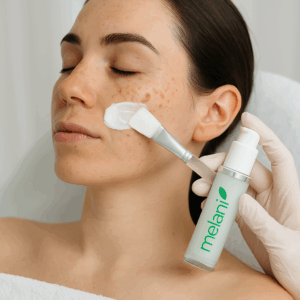 PROTOCOLO MANCHAS MELAINE