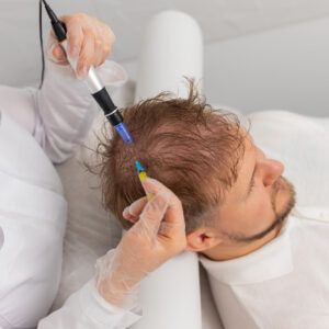 DERMAPEN + EXOSOMAS CAPILARES