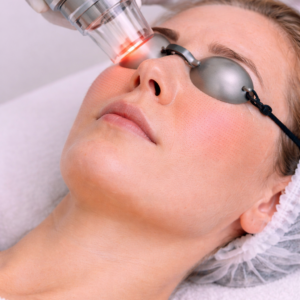 LASER CO2 ROSTRO SIN OJOS