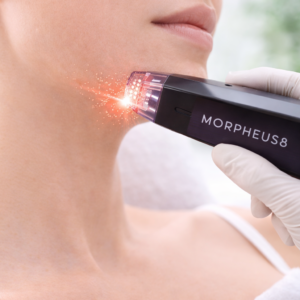 MORPHEUS 8 1/3 FACIAL