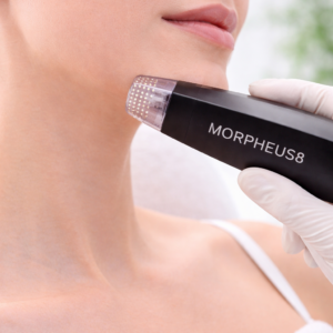 MORPHEUS 8 MEJILLAS Y PAPADA