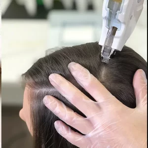 MESOJET + EXOSOMAS CAPILARES